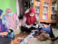 JKN di HST Capai 269 Ribu Jiwa, Penderita Tumor Schwannoma Tak Perlu Khawatir Biaya Berobat